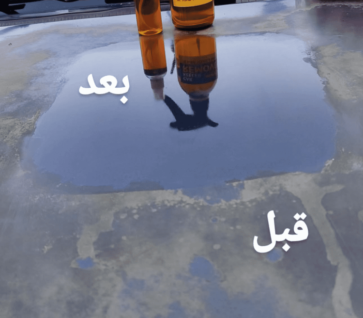 پک کامل رفع آفتاب سوختگی خودرو